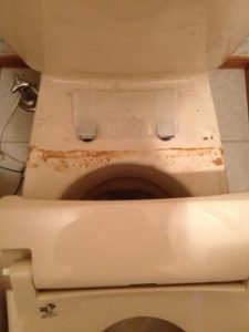 洗浄便座の汚れ